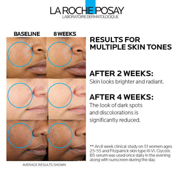 La Roche-Posay Glycolic Acid Serum with Kojic Acid and Vitamin B5, Reduces Dark Spots and Discoloration, Skin Tone Corrector to Brighten and Even Skin Tone